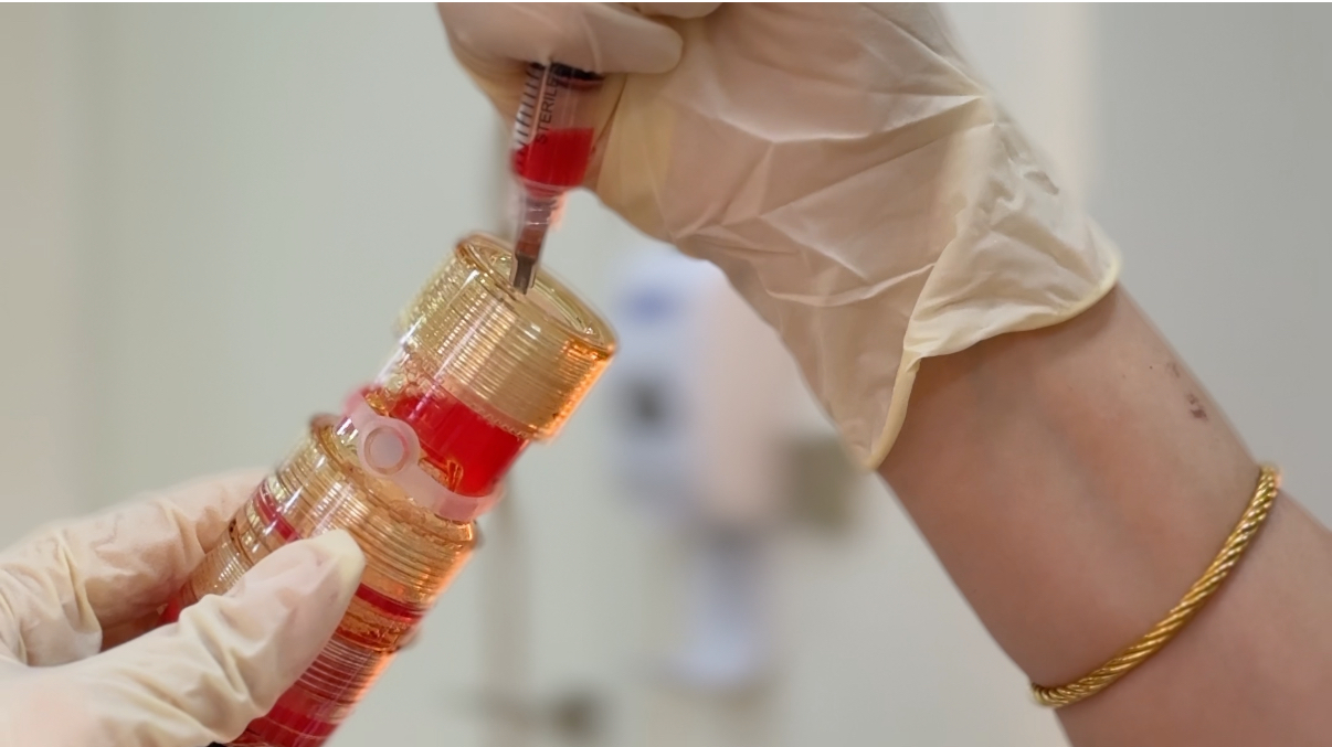 best maxxi prp treatment in dubai
